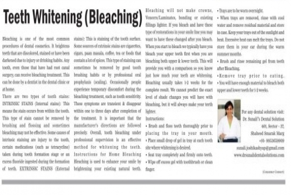 Teeth whitening tips by Dr.Sunali Joshi Kashyap