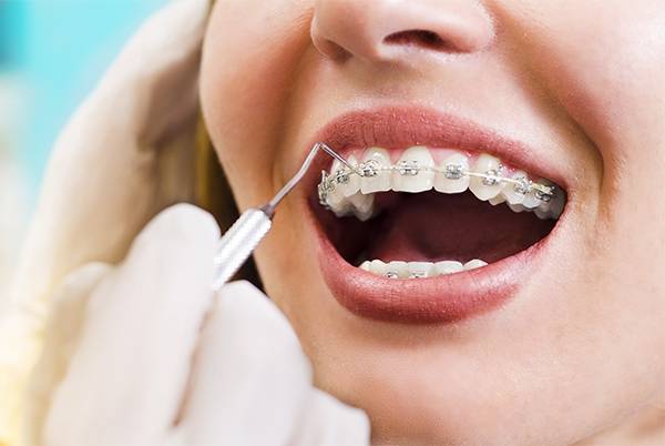 SEEKING AN ORTHODONTIC TREATMENT? VISIT DR.SUNALI DENTAL SOL...