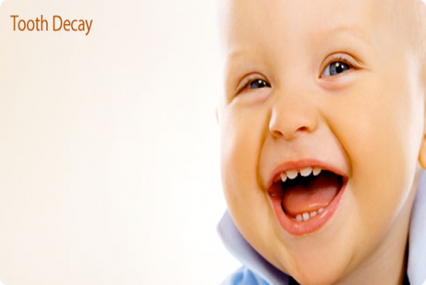 BABY BOTTLE TOOTH DECAY