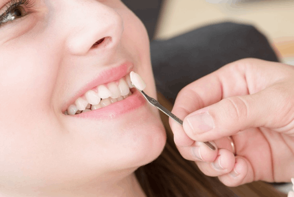 Get Your Dream Smile with Porcelain Veneers