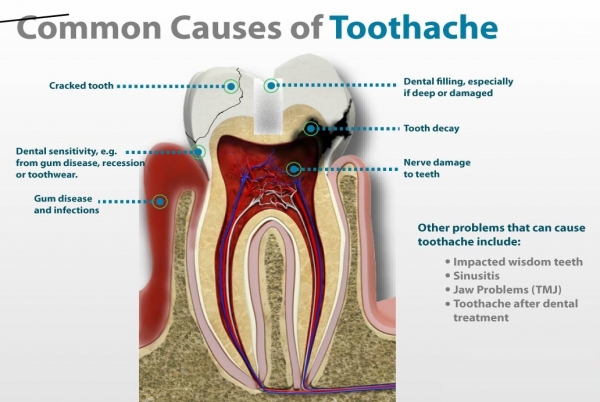 Dental Health and Toothaches