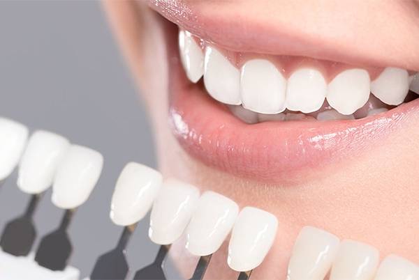 Smile Confidently with Porcelain Veneers