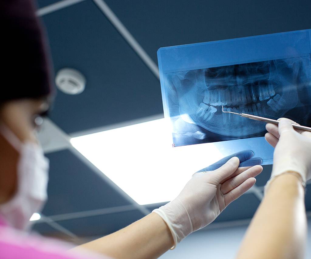 Dental X-Ray in Noida - dental treatment in Noida