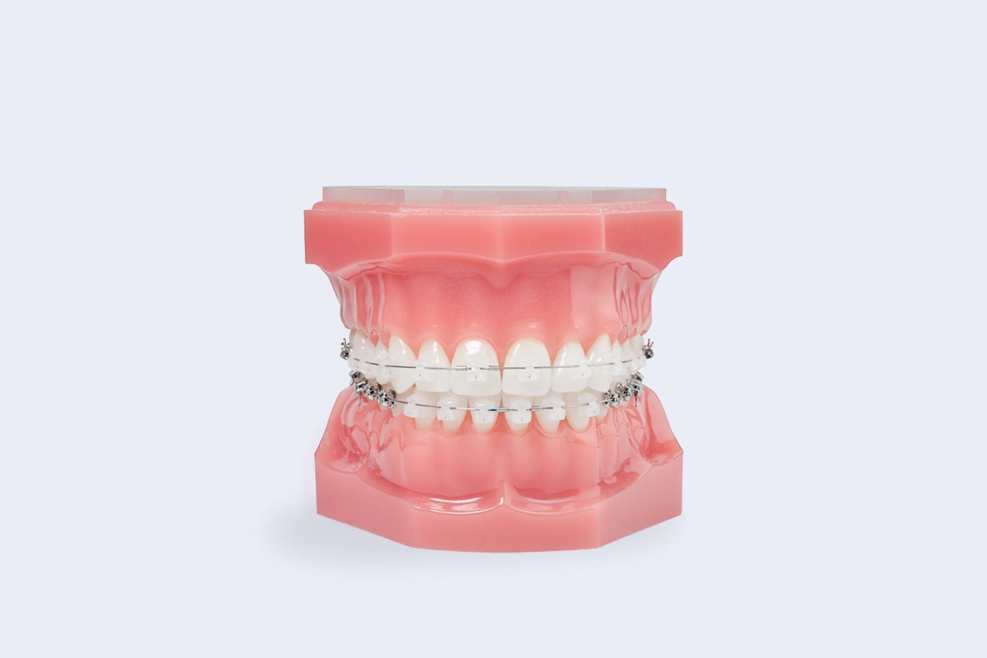 Orthodontic Solutions to Help Align Your Smile at Any Age