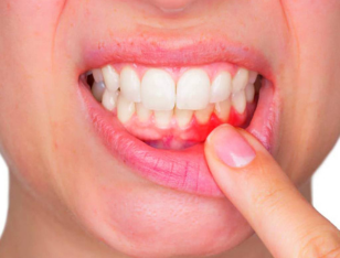 Is gum treatment safe?
