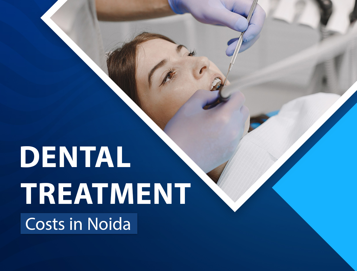 Affordable Dental Treatment Costs in Noida: What Patients Sh...