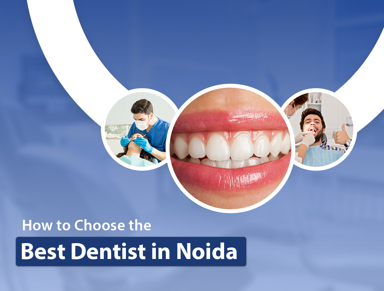 How to Choose the Best Dentist in Noida: A Complete Patient ...