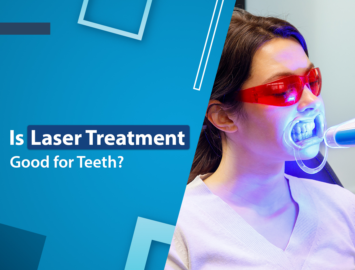 Is laser treatment good for teeth?