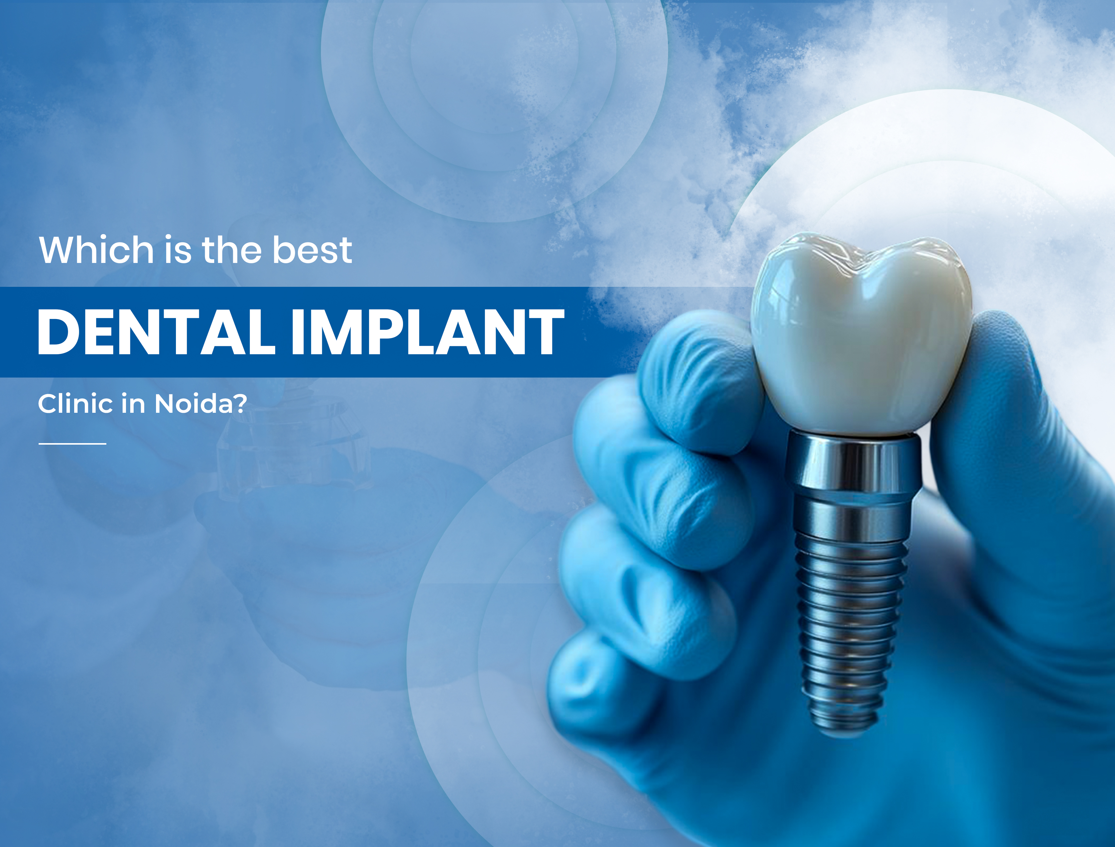 Which is the best dental implant Clinic in Noida?