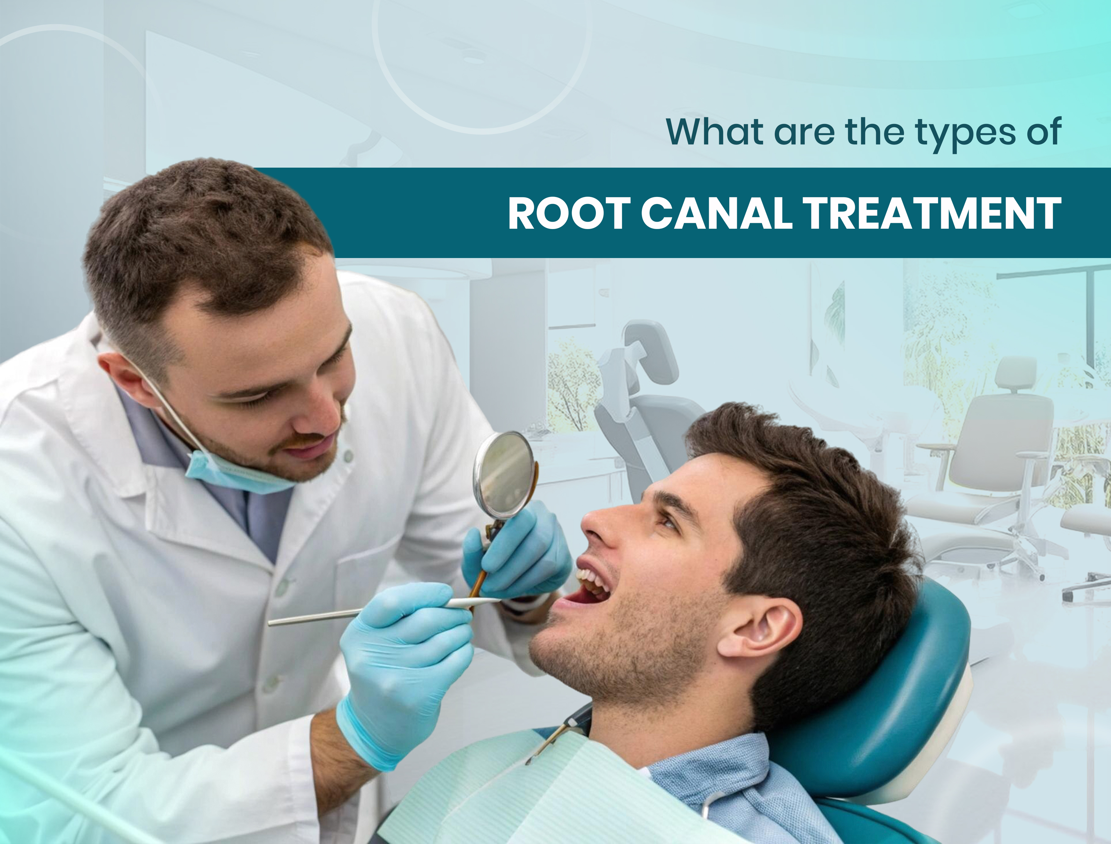 What are the types of root canal treatment?