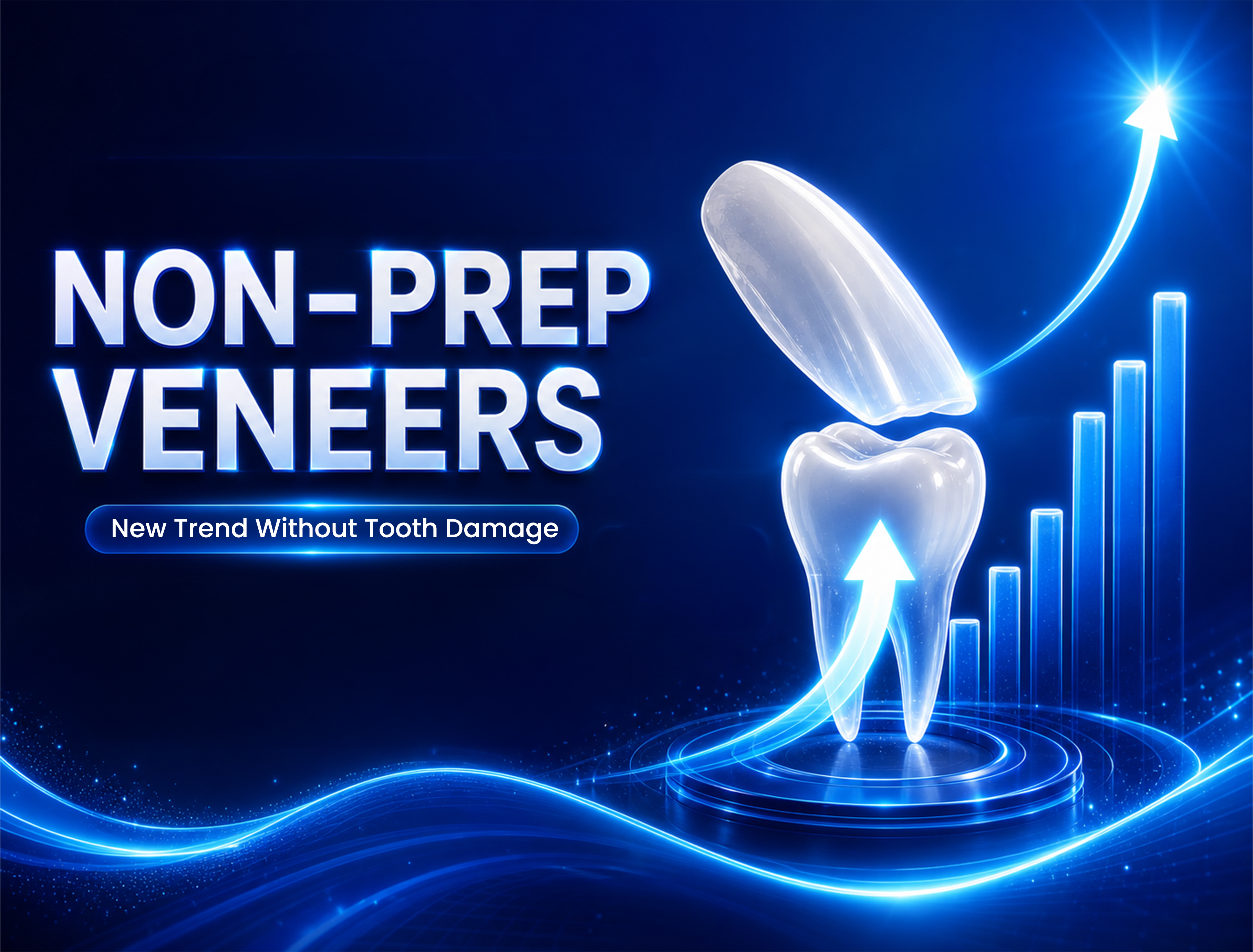 No-Prep Veneers: New Trend Without Tooth Damage
