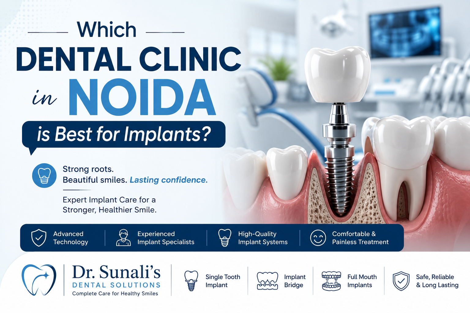 Which Dental Clinic in Noida is Best for Implants?