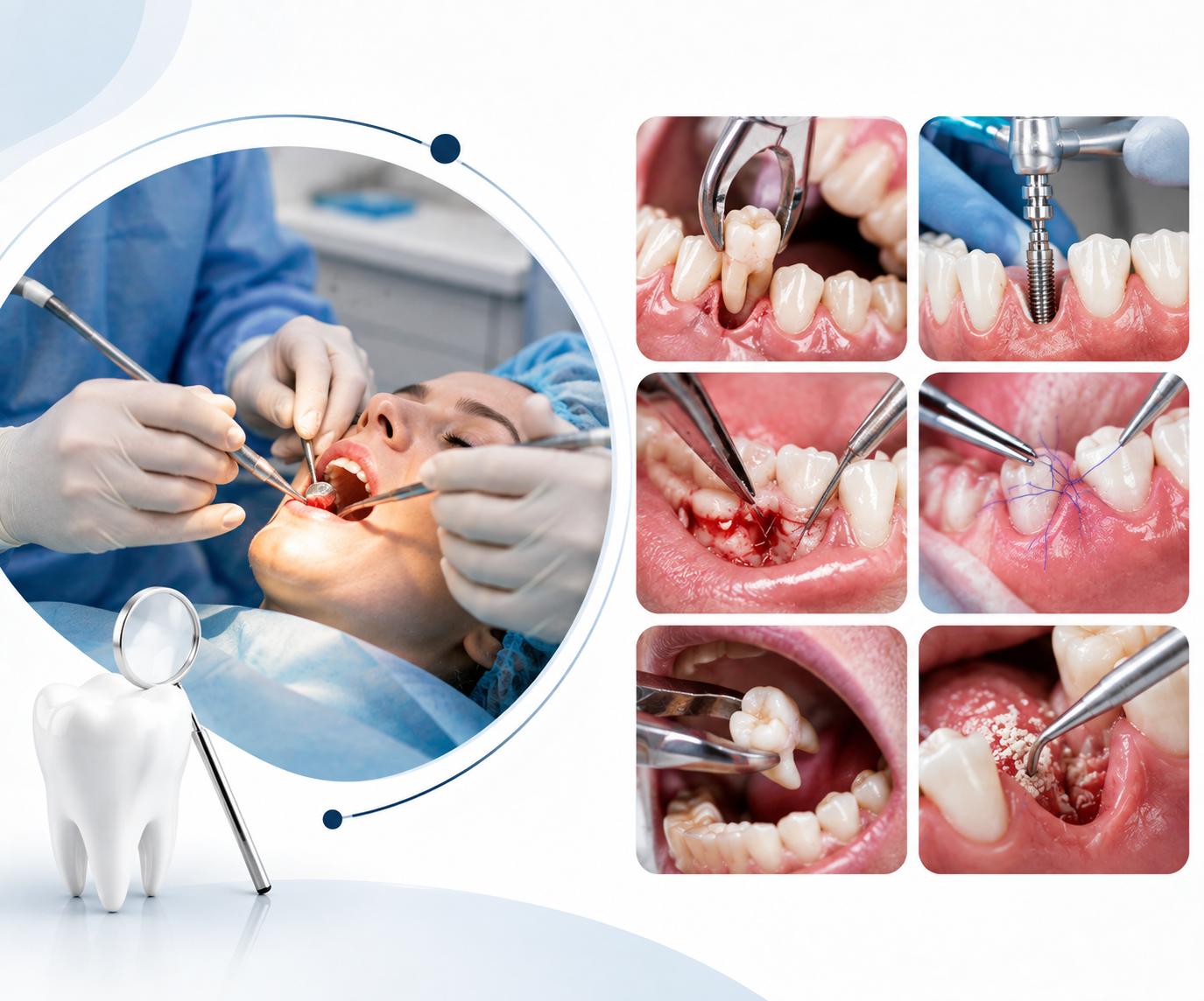 Dental Procedure in Noida - dental treatment in Noida