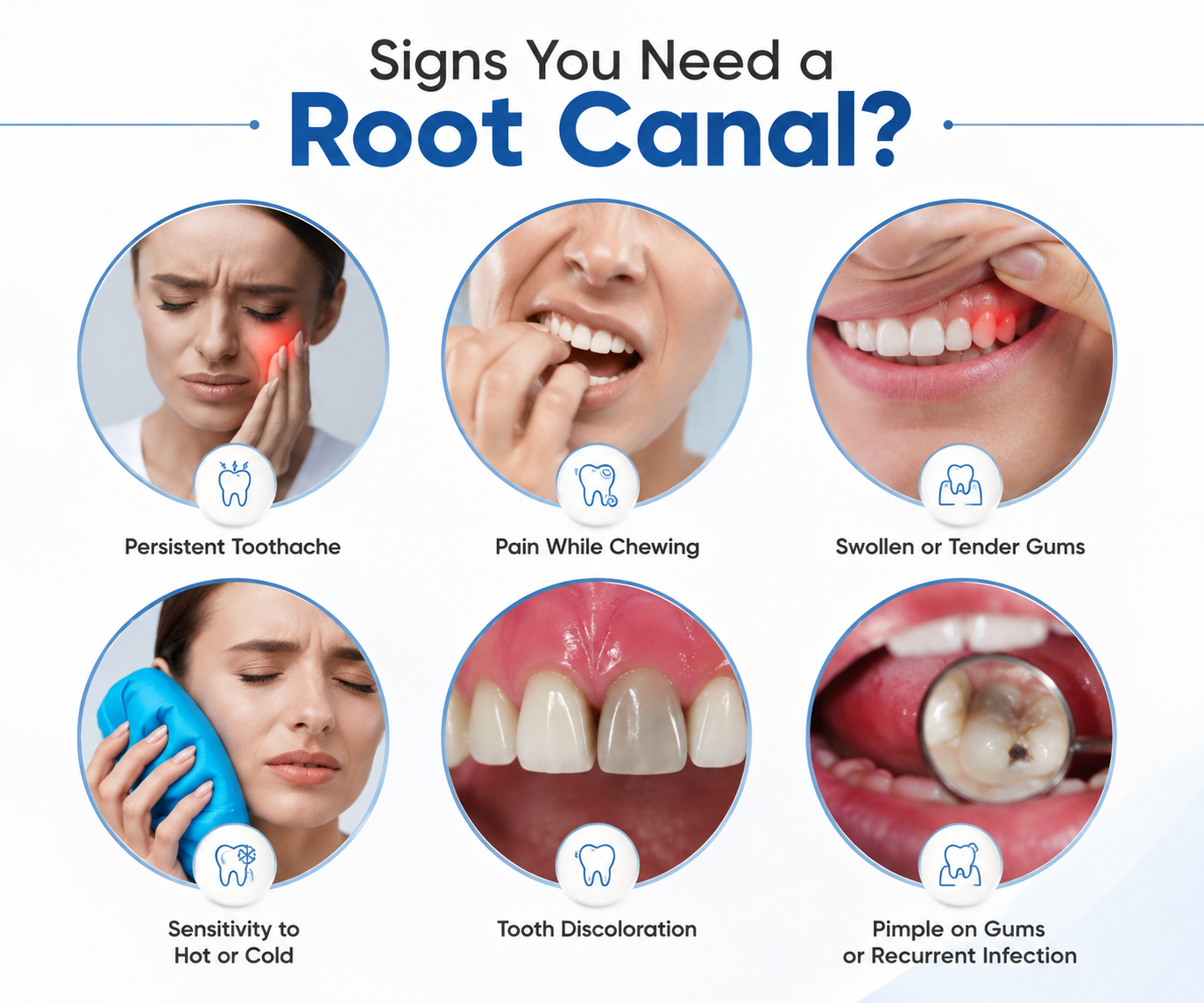 Root Canal Treatment in Noida - dental treatment in Noida