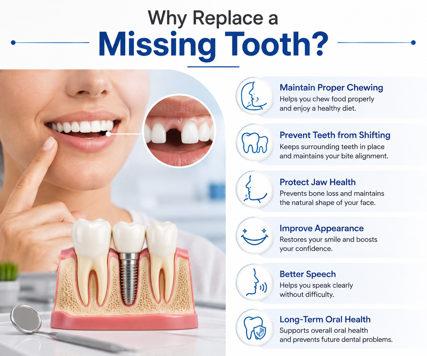 Dental Implant in Noida - dental treatment in Noida