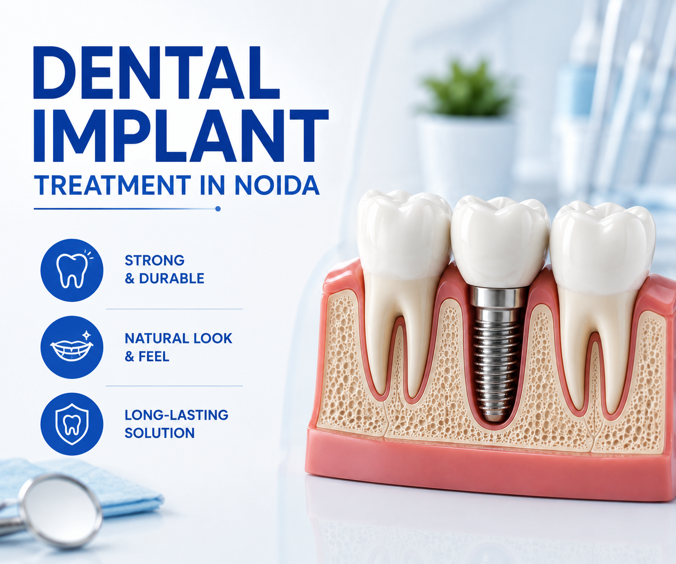 Dental Implant in Noida - dental treatment in Noida